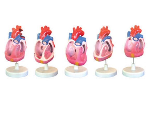 先天性心脏畸形模型.jpg