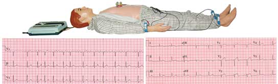 XD-Ⅰ型 多种心电图电脑模拟人.jpg