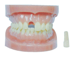 可卸式无根标准牙模型.gif