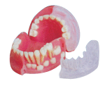 三岁乳恒牙交替解剖模型.gif