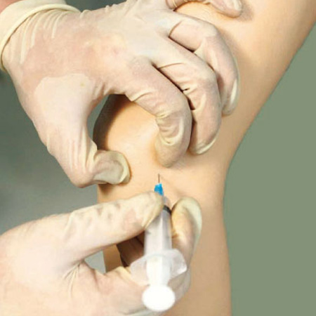 L71高级电子肘关节腔内注射模型2.jpg