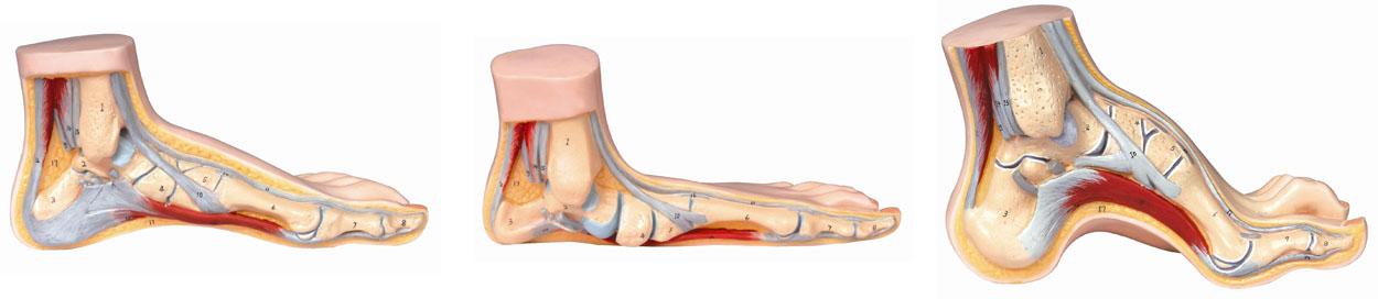 正常足、平底足、弓形足模型A11310.jpg