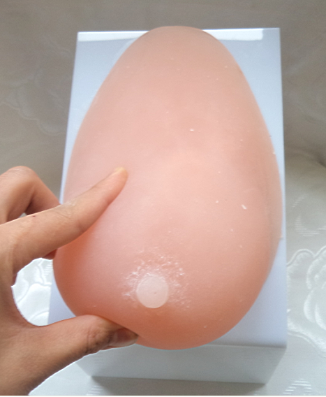 单乳模型1.png