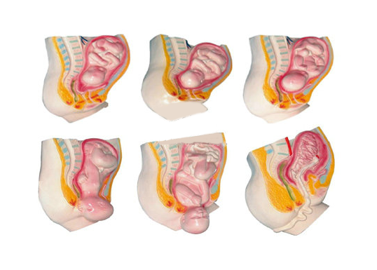 足月胎儿分娩过程模型6.png