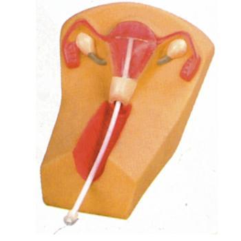 女性宫内避孕器及训练模型.jpg